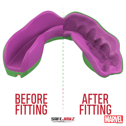 MARVEL THE HULK MOUTHGUARD